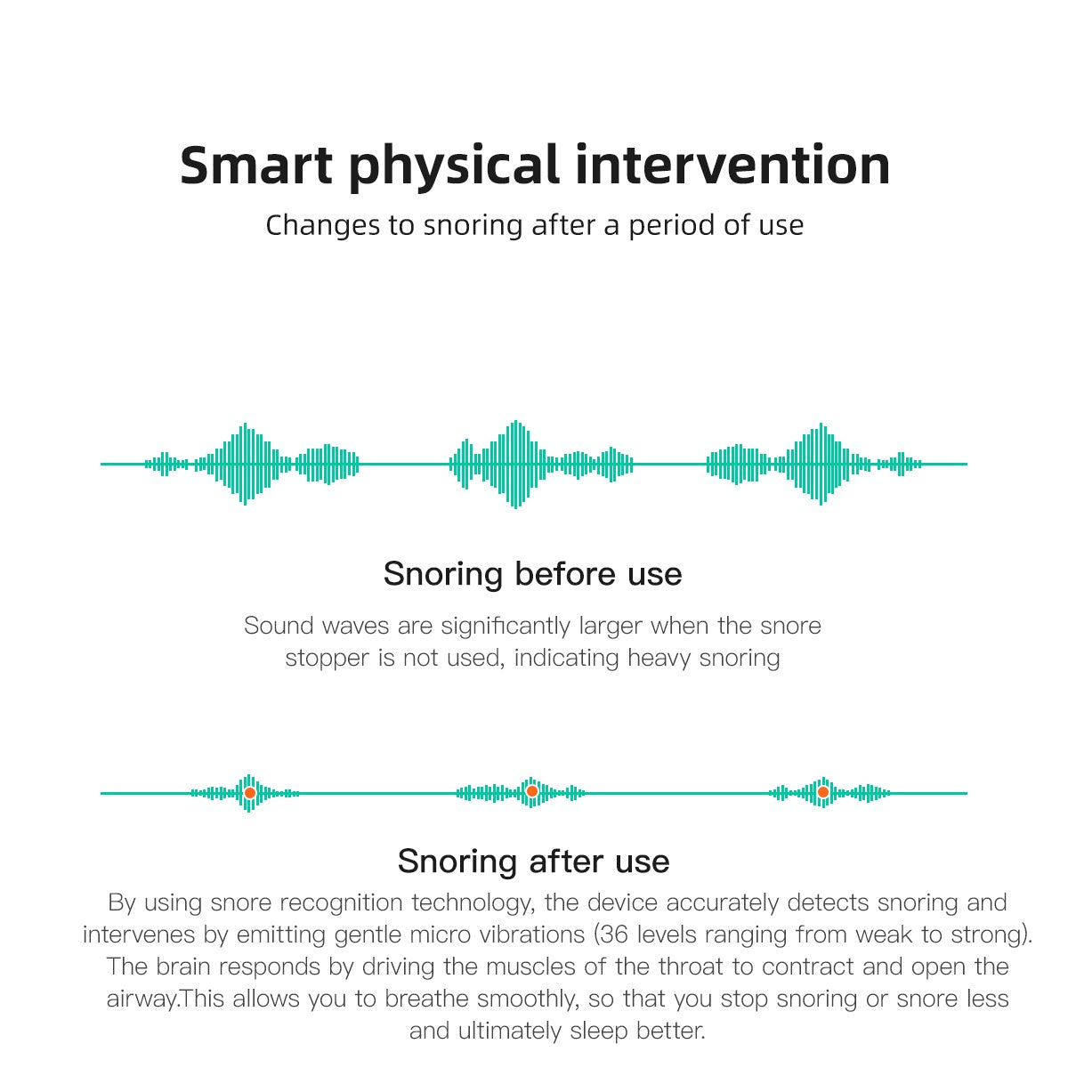 Anti-Snoring Device