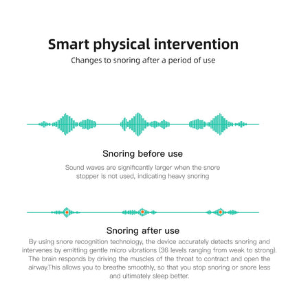 Anti-Snoring Device